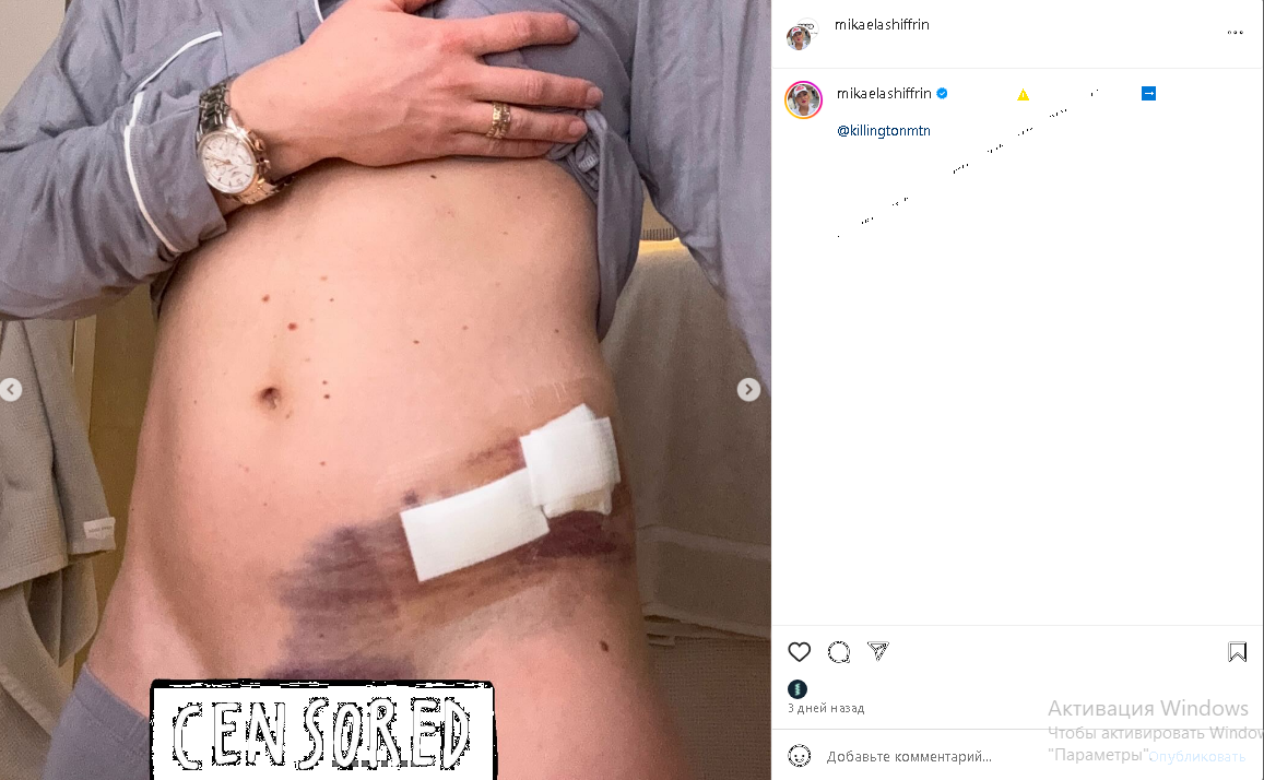 Pic Жена показала свои дырки крупным планом